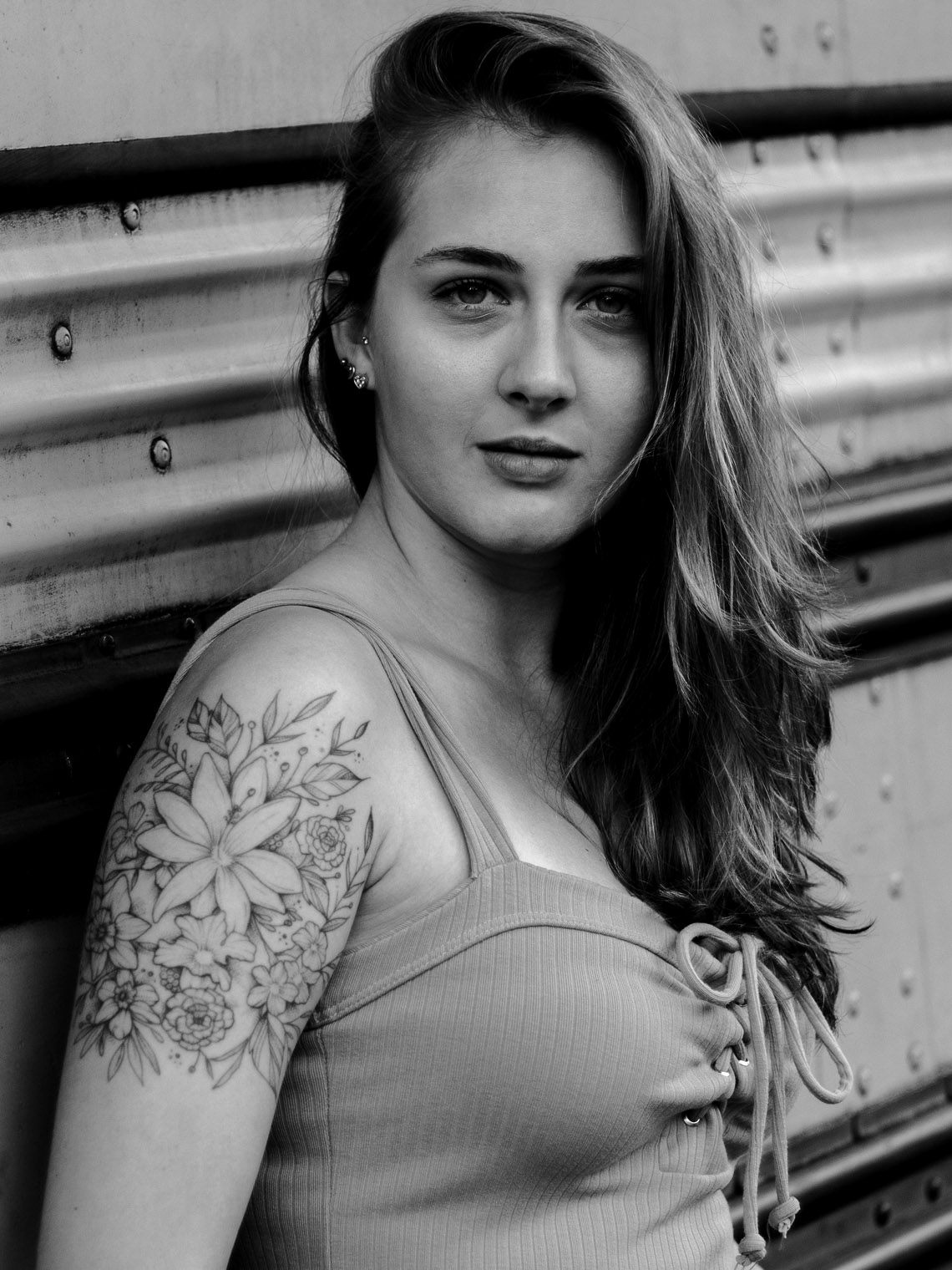 Pico Laser Αφαίρεση Πανάδων